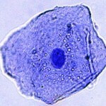 Bild einer Mundschleimhautzelle FERAGEN LNF