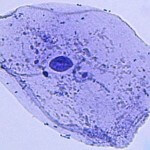 Bild einer Mundschleimhautzelle mit Zellkern